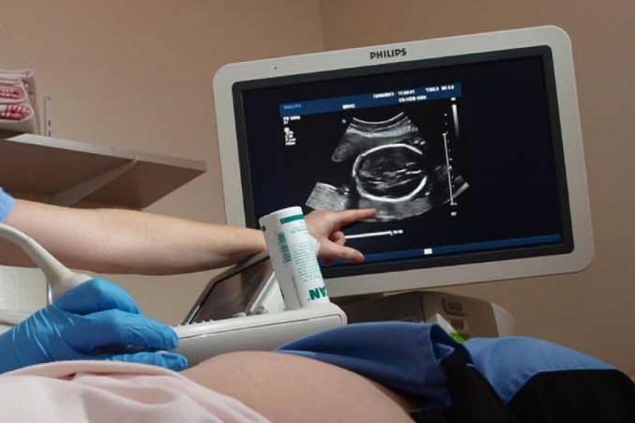 A hand points to a black and white monitor during an ultrasound.