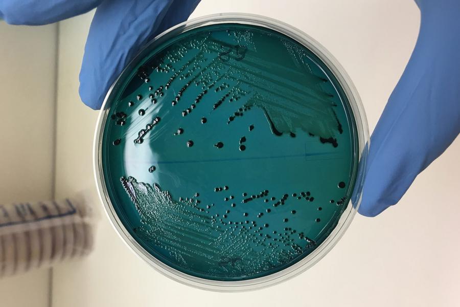 A hand holds a petri dish.