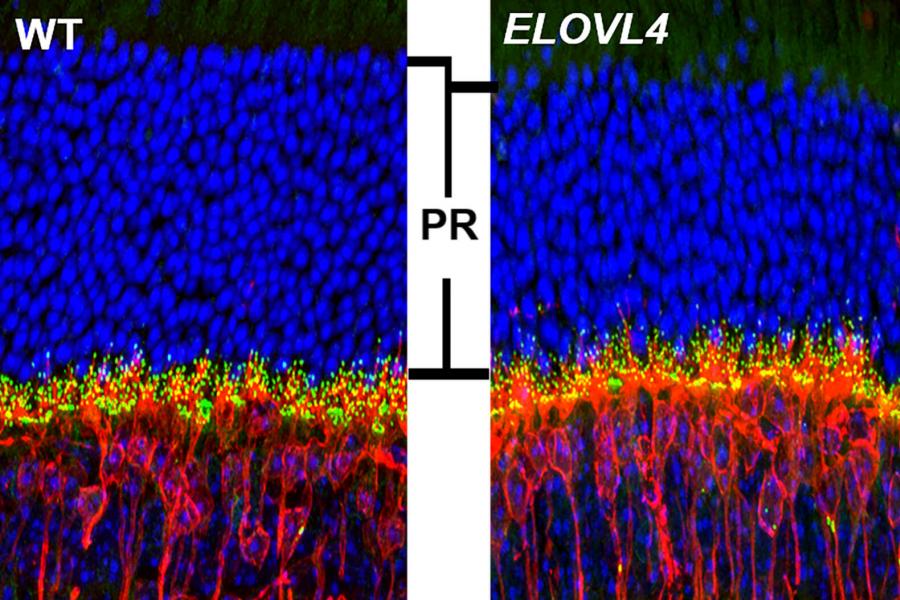 A retina histology of ELOVL4 mice