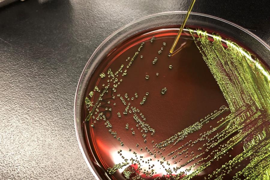 E.coli bacteria in a petri dish growth medium