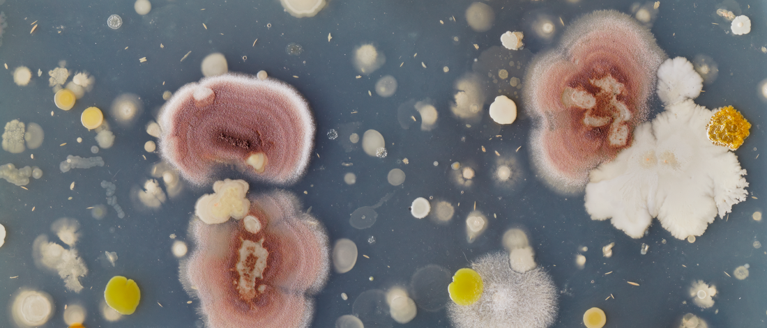 A close-up of diverse bacterial and fungal colonies in various colors and textures growing on a petri dish.