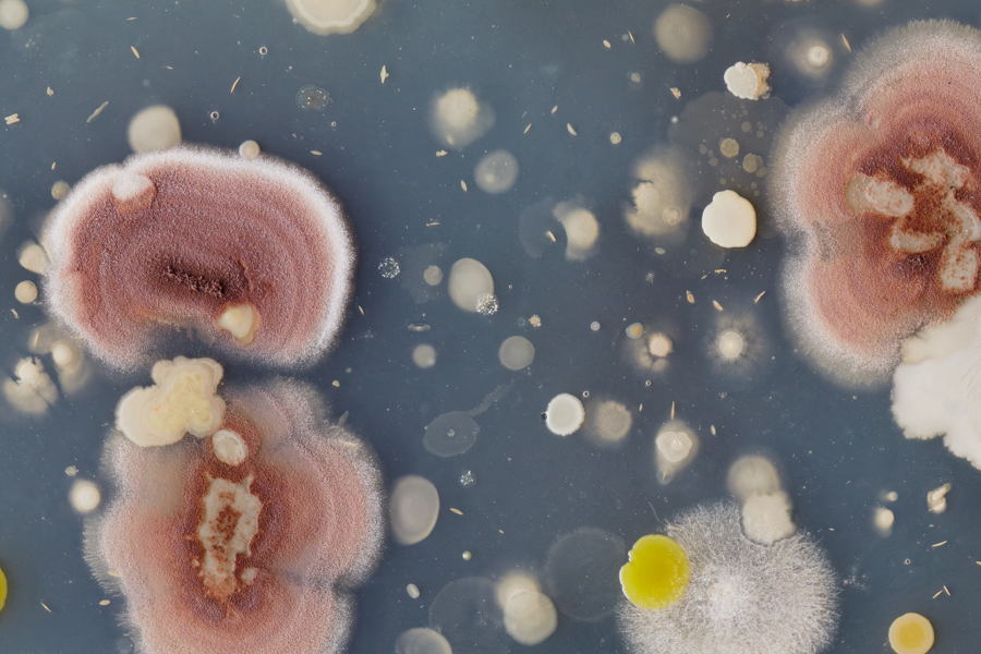 A close-up of diverse bacterial and fungal colonies in various colors and textures growing on a petri dish.