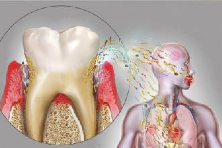 A graphic illustration demonstrating how oral health effects your overall systemic health.