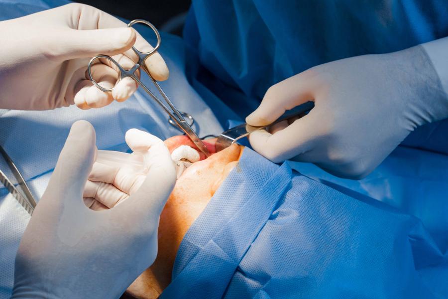 A patient undergoing a surgical dental procedure