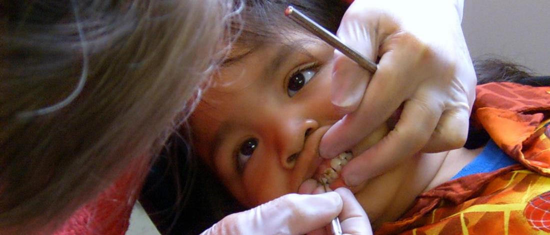 A dentists looks at a young patients front teeth.