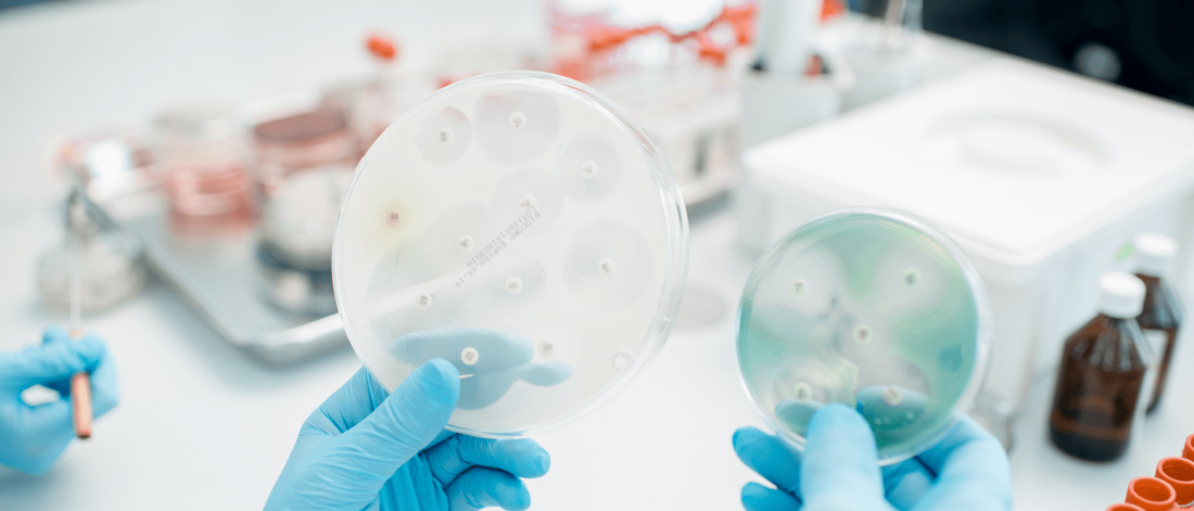 A person holding two petri dishes.