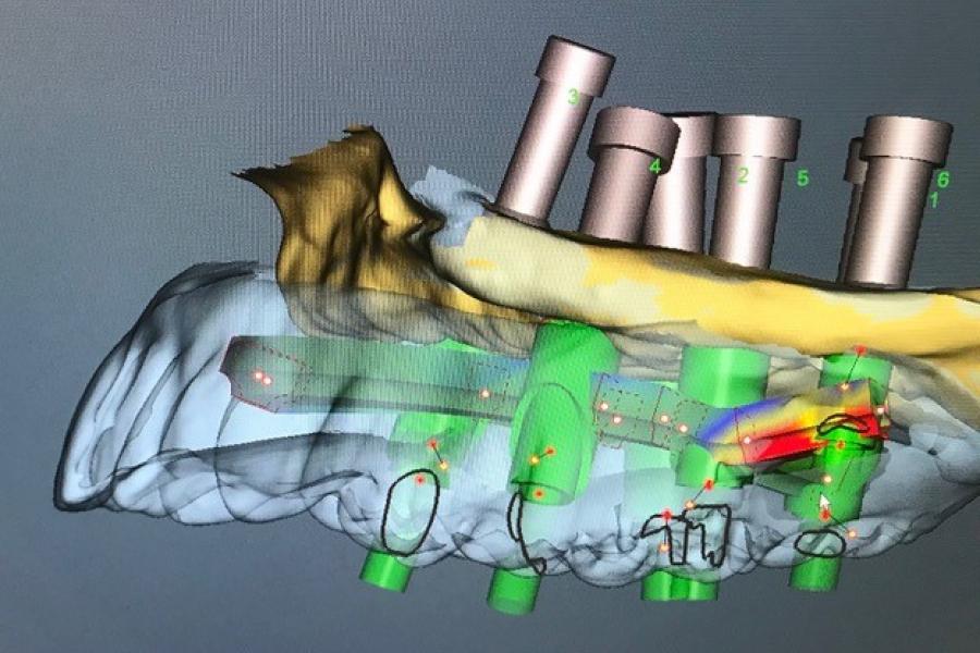 Dentistry image prosthodontics