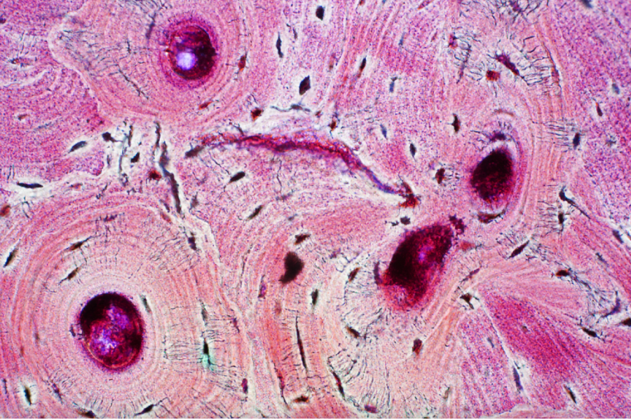 histology of human compact bone tissue microscopic view.