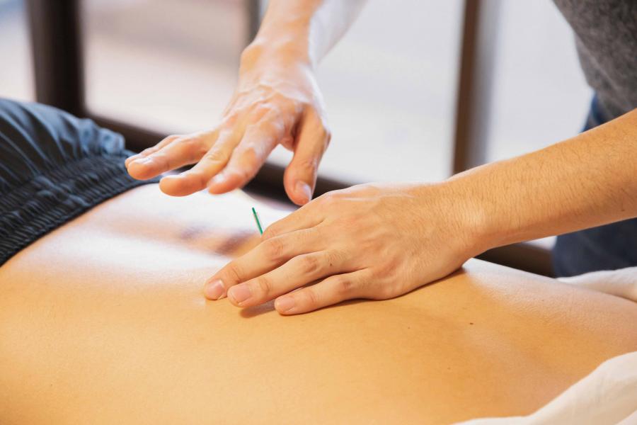 A closeup view of a practitioner inserting an acupuncture needle into a laying patient's back.