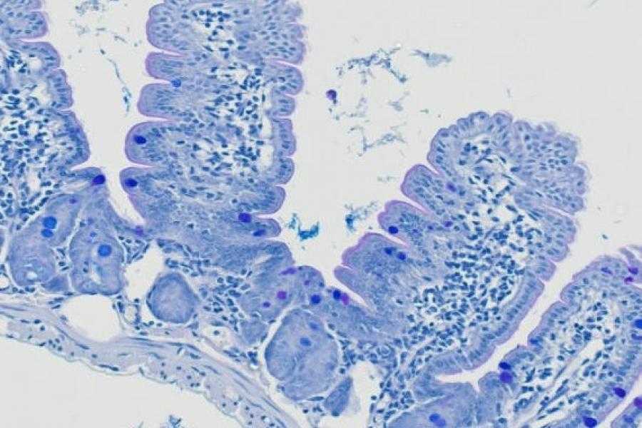 A close up of a slide with cells dyed blue.