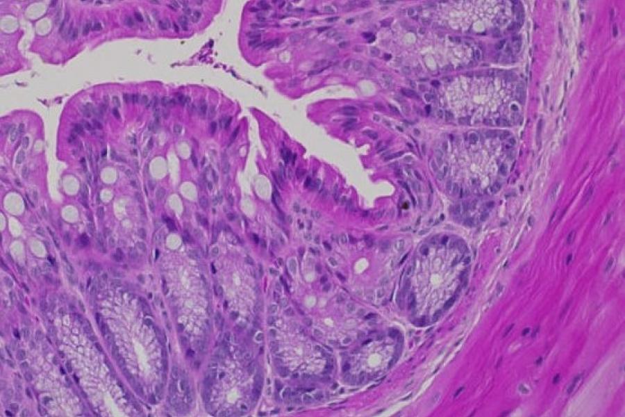 A close up of a slide with cells stained bright fuchsia.
