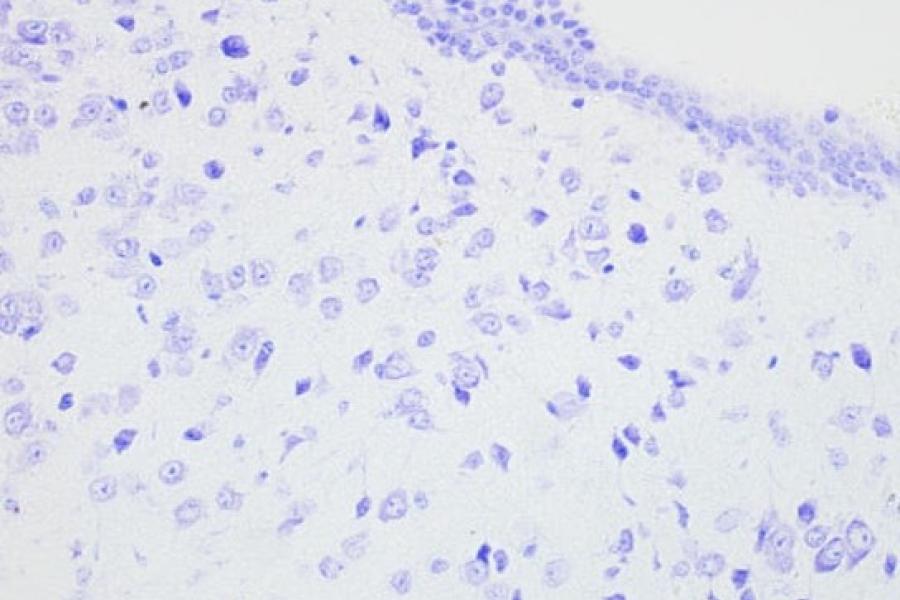 A close up of a slide with cells stained blue.