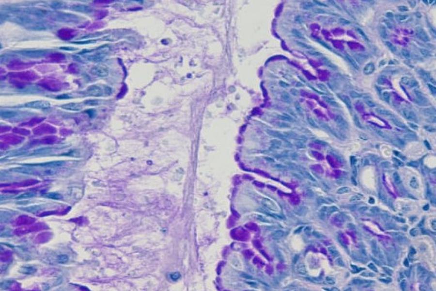 Image of a slide with cells stained blue and purple.