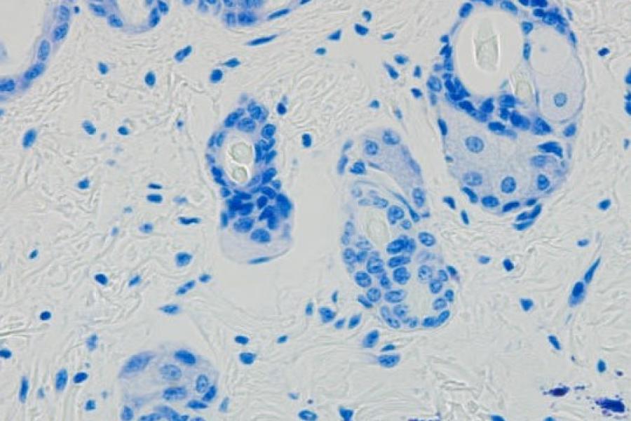 A close up of a slide with cells stained blue.