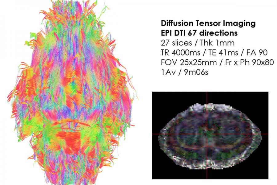 Diffusion tensor imaging of the rat brain.