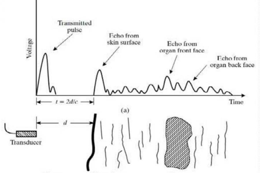 Graphic describing ultrasound imaging.