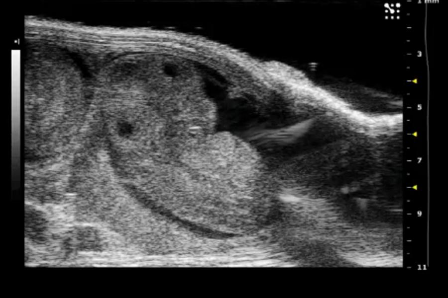 Ultrasound image of a mouse embryo.