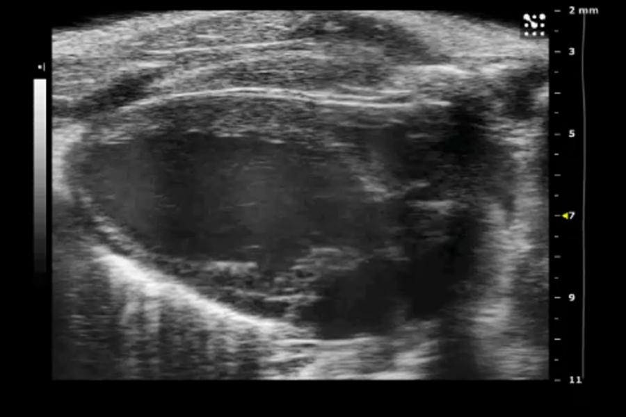 Ultrasound image of a rat heart.
