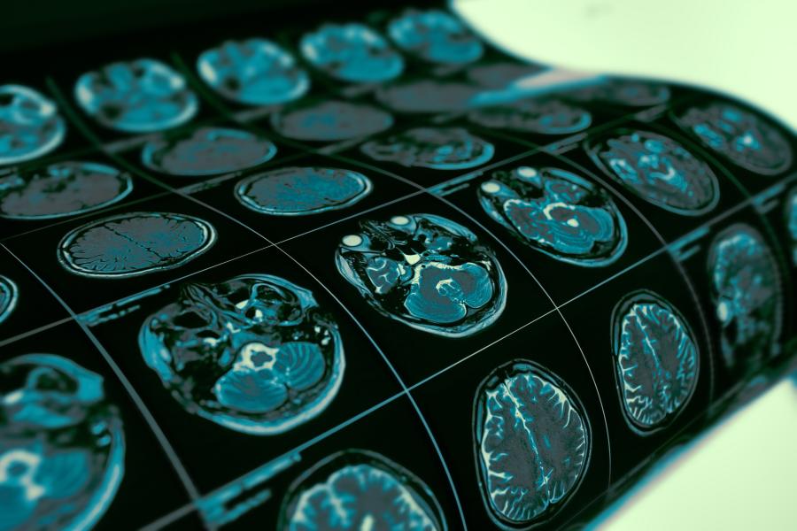 brain imaging x-rays