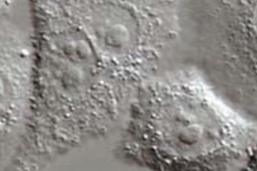 A microscopic image of a live cell using DIC contrast.