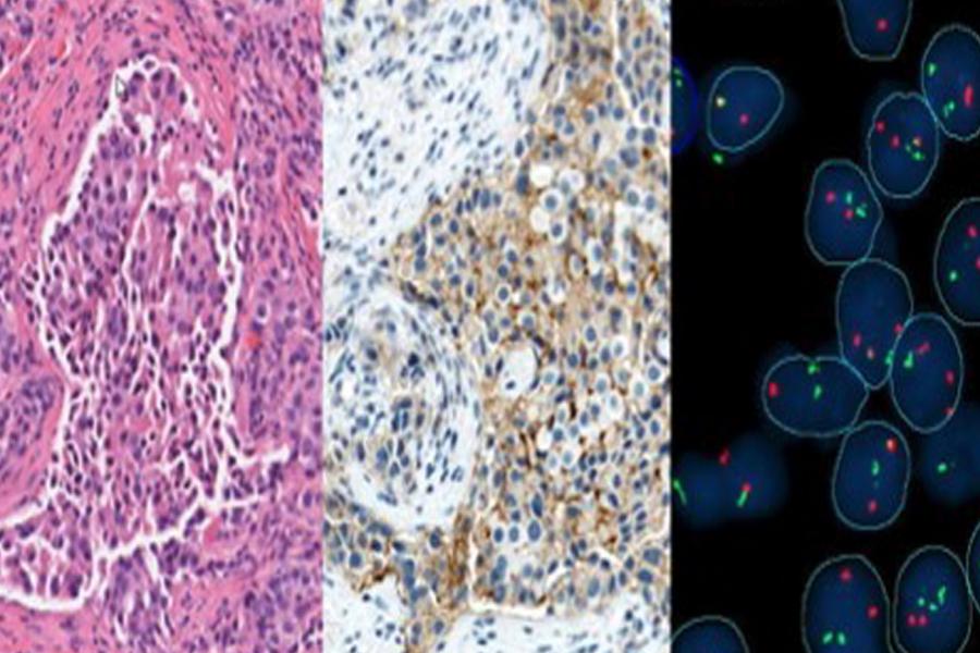 Tissue images with three different methods; brightfield H&E, bright field immunostained and fluorescence