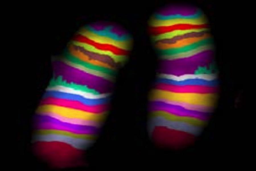 Two chromosomes displayed with multicolor banding patterns, showing distinct segments for analysis.