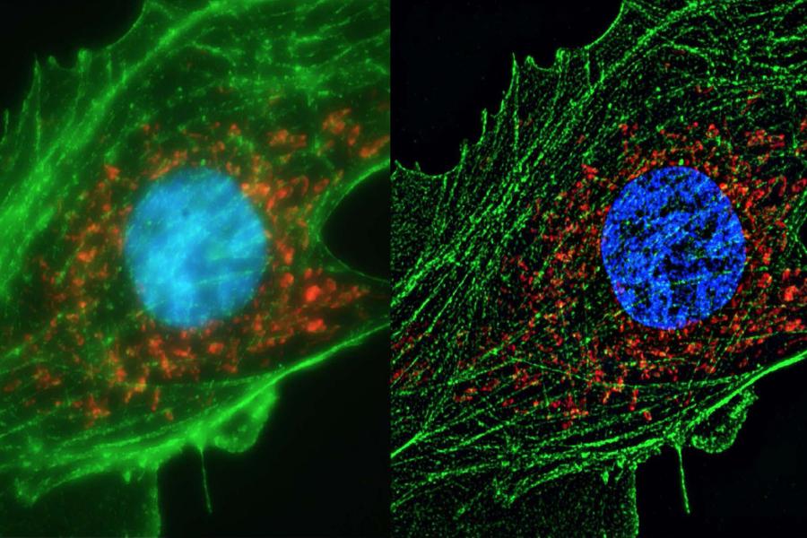 Comparison image showing a triple-stained cell as viewed under wide-field microscopy and super-resolution microscopy, highlighting the enhanced detail and clarity provided by super-resolution techniques.