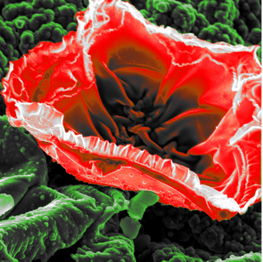 Example 1 of an edited submission for the microscopy image competition