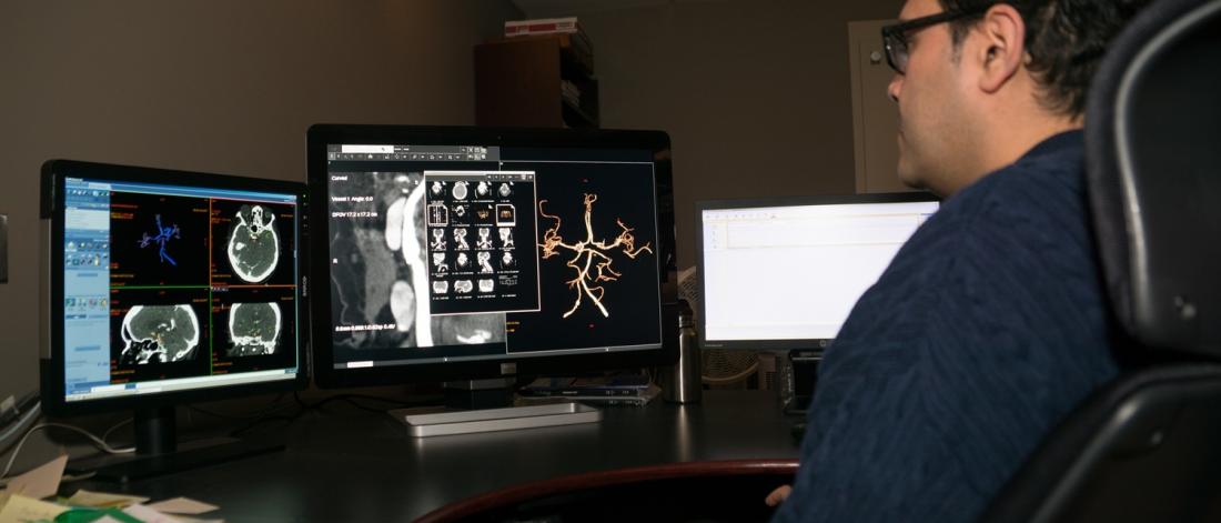 Researcher examines brain scans