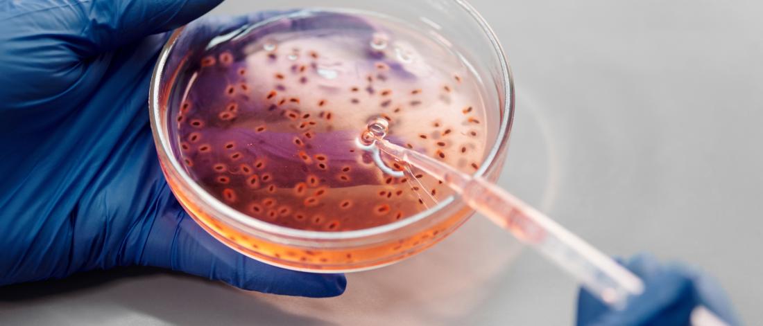 Petri dish