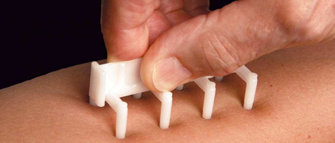 Allergy test.