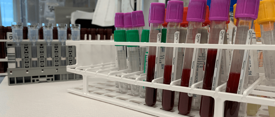 A row of test tubes filled with blood samples.