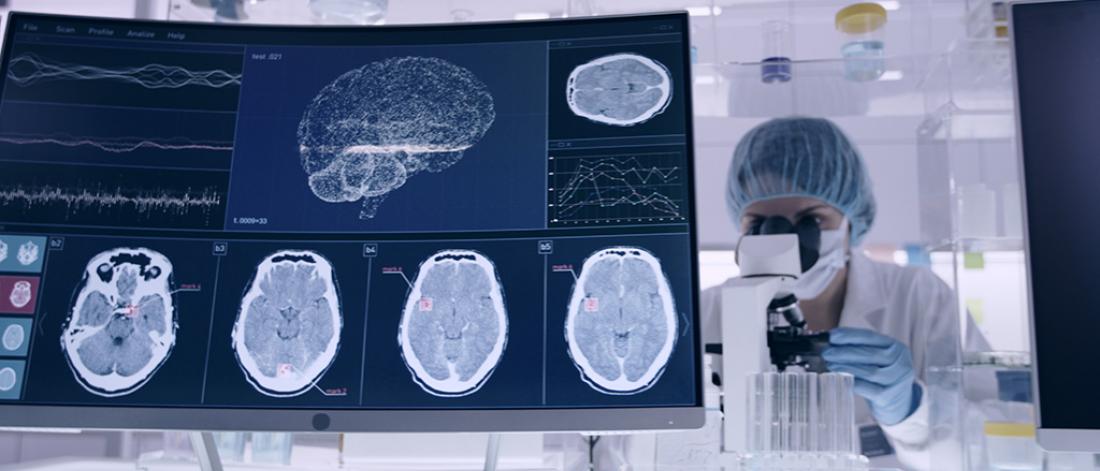 Image of a scientist looking into a microscope in a lab setting. Brain x rays are displayed on a monitor.