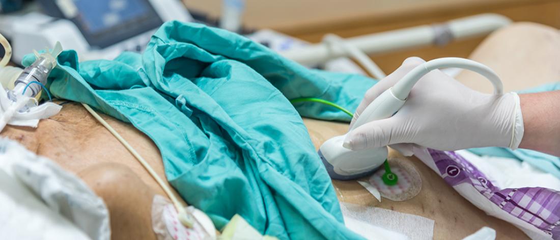 A patient is undergoing an emergency ultrasound in the intensive care unit.