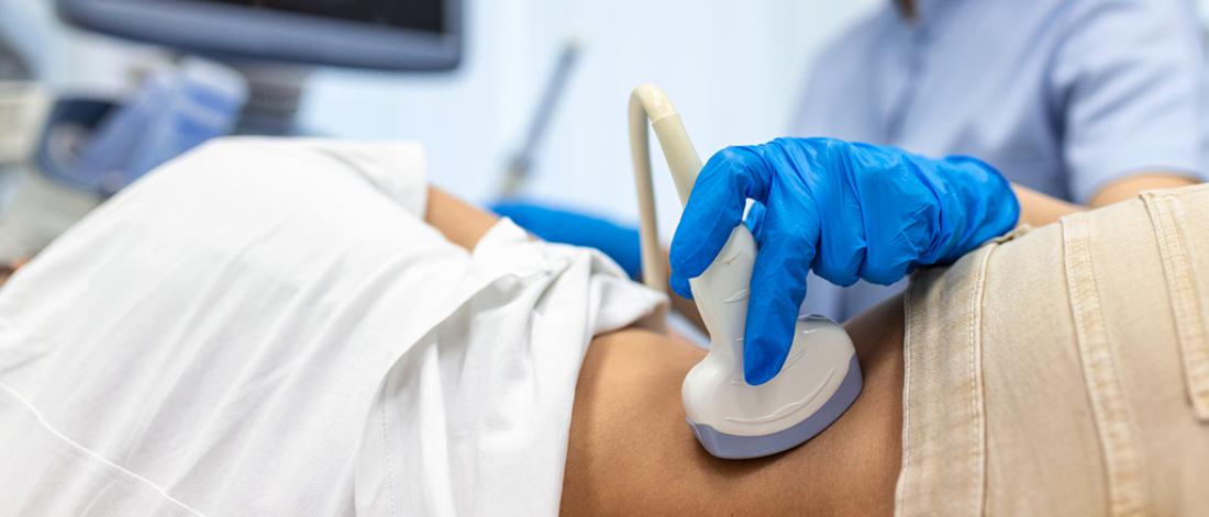 A close up view of a doctor doing an ultrasound of a patient's kidneys.