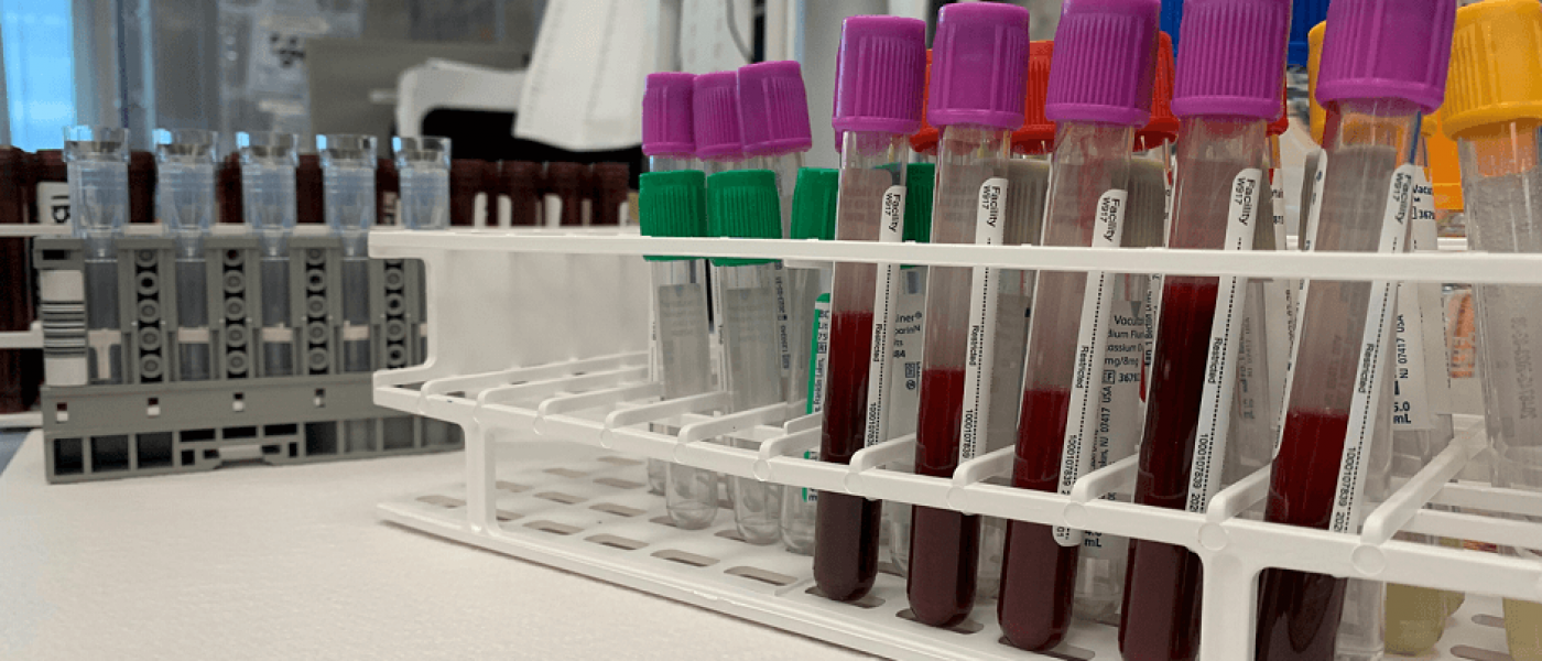 Blood specimen tubes prepared for laboratory testing