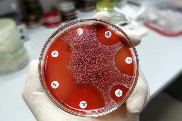 Department of Medical Microbiology and Infectious Diseases | Max Rady ...