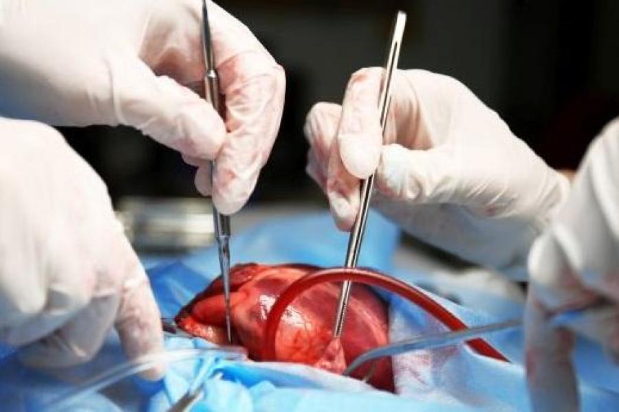 Heart surgery close-up.