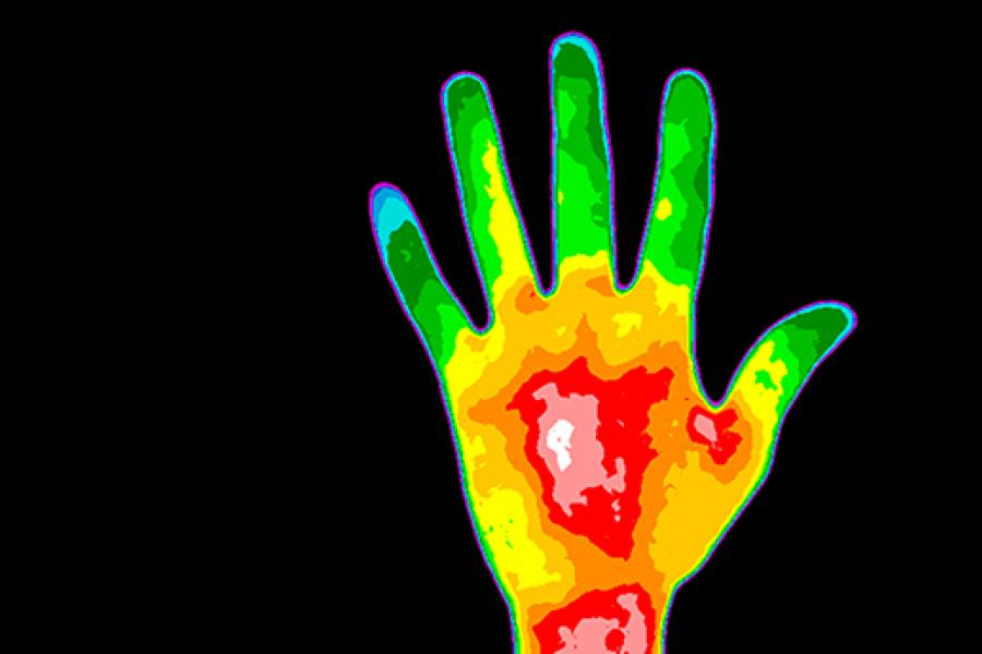 Scan of a human hand.