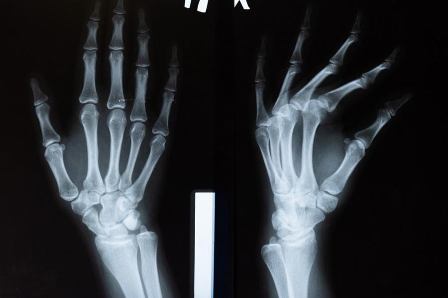xray image of a hand.