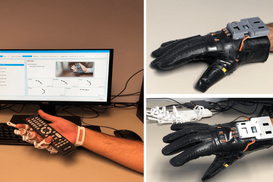 Electronic hands for physical therapy patients