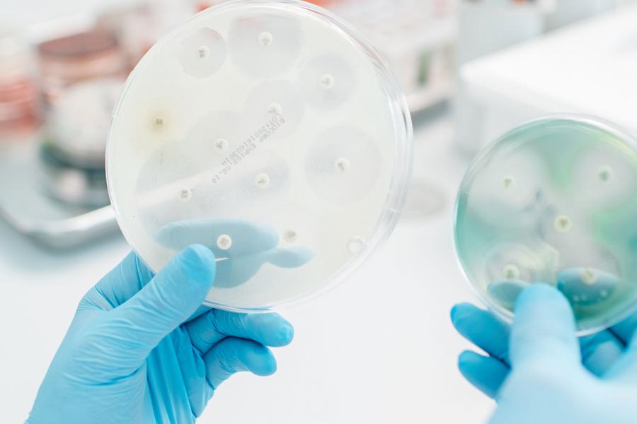 A close up of a bacteria research on a petri dish